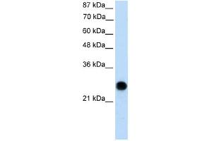 VDAC2 antibody used at 0. (VDAC2 antibody  (N-Term))