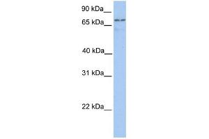 WB Suggested Anti-TGM7 Antibody Titration:  0.