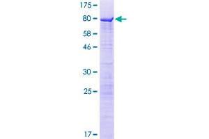 Spermatogenesis Associated, Serine-Rich 2-Like (SPATS2L) (AA 1-488) protein (GST tag)