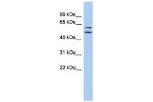 Image no. 1 for anti-Abhydrolase Domain Containing 15 (ABHD15) (AA 107-156) antibody (ABIN6743745) (ABHD15 antibody  (AA 107-156))