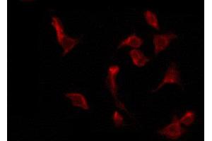 ABIN6274248 staining HeLa by IF/ICC. (RBMX antibody  (N-Term))