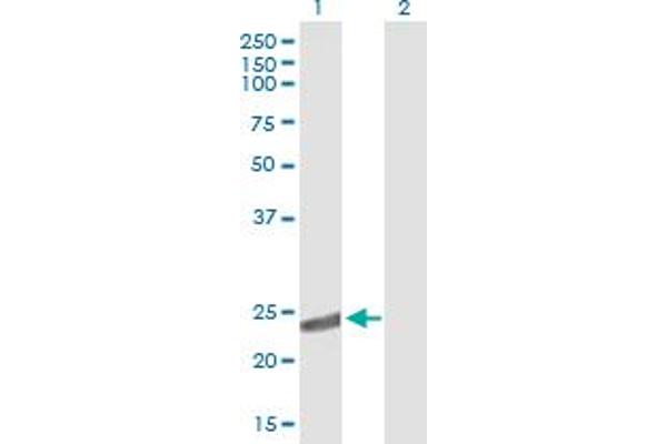CRYbA2 antibody  (AA 1-197)
