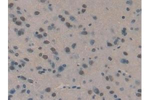 Detection of HCII in Rat Brain Tissue using Polyclonal Antibody to Heparin Cofactor II (HCII) (SERPIND1 antibody  (AA 25-235))