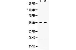 Western blot analysis of ACVR2B expression in rat skeletal muscle extract ( Lane 1) and MCF-7 whole cell lysates ( Lane 2).