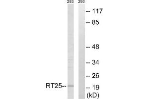Western blot analysis of extracts from 293 cells, using MRPS25 antibody. (MRPS25 antibody  (C-Term))