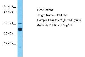 Host: Rabbit Target Name: TDRD12 Sample Type: 721_B Whole Cell lysates Antibody Dilution: 1. (TDRD12 antibody  (C-Term))