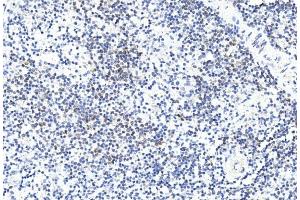 Immunohistochemical analysis of paraffin-embedded human spleen section using GREMLIN Antibody (C-term) (ABIN390078 and ABIN2840598). (GREM1 antibody  (C-Term))