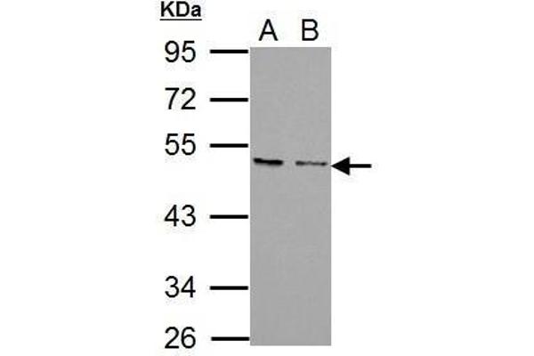 CXCR7 抗体