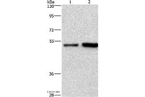 Western blot analysis of Hela and Jurkat cell, using SYT4 Polyclonal Antibody at dilution of 1:700 (SYT4 antibody)