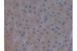 Detection of C3 in Human Liver Tissue using Polyclonal Antibody to Complement Component 3 (C3) (C3 antibody  (AA 1000-1326))