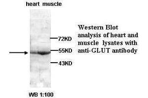 Image no. 1 for anti-Solute Carrier Family 2 (Facilitated Glucose Transporter), Member 1 (SLC2A1) antibody (ABIN790880) (GLUT1 antibody)