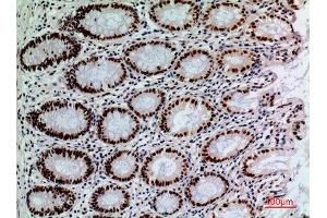 Immunohistochemistry (IHC) analysis of paraffin-embedded Human Colon, antibody was diluted at 1:100. (SLAMF1 antibody  (Tyr1096))
