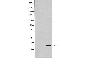 Western blot analysis of p18 INK expression in Cos7 cell extract. (P18 INK antibody)