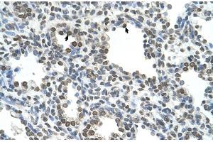 Rabbit Anti-NKD1 Antibody  Paraffin Embedded Tissue: Human Lung Cellular Data: Alveolar cells Antibody Concentration: 4. (NKD1 antibody  (N-Term))