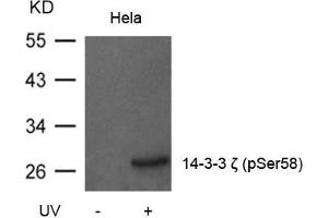 Western blot analysis of extracts from Hela cells untreated or treated with UV using 14-3-3z(Phospho-Ser58) Antibody. (14-3-3 zeta antibody  (pSer58))