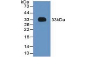 WB of Protein Standard: different control antibodies against Highly purified E. (Prothrombin ELISA Kit)