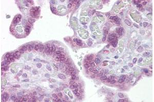 Anti-IRF6 antibody IHC staining of human placenta. (IRF6 antibody  (AA 395-444))