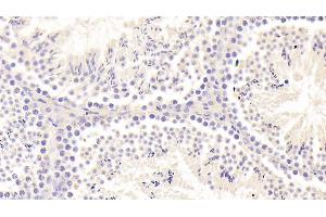 Detection of FOXO1 in Mouse Testis Tissue using Polyclonal Antibody to Forkhead Box Protein O1 (FOXO1) (FOXO1 antibody  (AA 222-469))