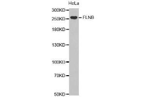 Western Blotting (WB) image for anti-Filamin B, beta (FLNB) (AA 1686-1785) antibody (ABIN6219554) (FLNB antibody  (AA 1686-1785))