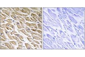 Immunohistochemistry analysis of paraffin-embedded human heart tissue, using MRPL39 Antibody. (MRPL39 antibody  (AA 289-338))
