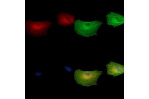 ABIN7097065 and ABIN7101132 staining  cells by IF/ICC. (GGN antibody)