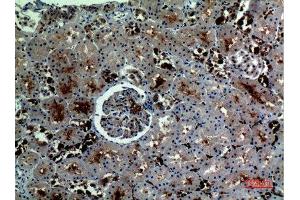 Immunohistochemistry (IHC) analysis of paraffin-embedded Human Kidney, antibody was diluted at 1:100. (Catalase antibody  (C-Term))