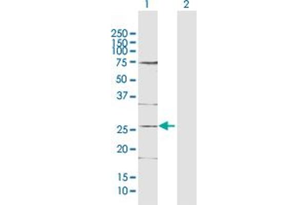 DDIT4L anticorps  (AA 1-193)