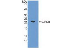 Detection of Recombinant a1AGP, Human using Monoclonal Antibody to Alpha-1-Acid Glycoprotein (a1AGP) (ORM1 antibody  (AA 19-201))