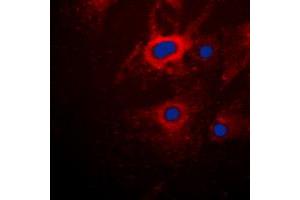 Immunofluorescent analysis of Cytokeratin 8 staining in HeLa cells. (KRT8 antibody  (C-Term))