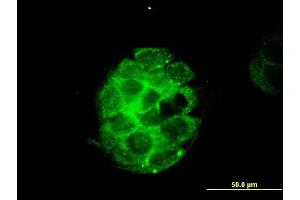 Immunofluorescence (IF) image for anti-V-Akt Murine Thymoma Viral Oncogene Homolog 3 (Protein Kinase B, Gamma) (AKT3) (AA 100-189) antibody (ABIN564303)