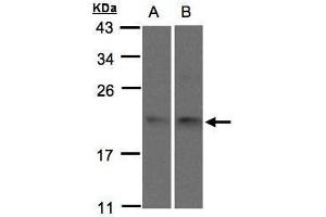 WB Image Sample(30 μg of whole cell lysate) A:293T B:H1299 15% SDS PAGE antibody diluted at 1:1500 (SNX12 antibody  (C-Term))