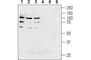 Western blot analysis of human  breast adenocarcinoma cell lysate (lanes 1 and 4), human U87-MG glioblastoma cell lysate (lanes 2 and 5) and human  breast adenocarcinoma cell lysate  (lanes 3 and 6):1-3. (Neuregulin 1 (NRG1) Peptide)