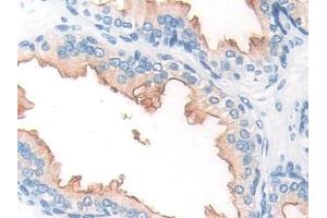 Detection of PMSA in Human Prostate Tissue using Polyclonal Antibody to Prostate-specific Membrane Antigen (PMSA) (PSMA antibody  (AA 274-587))