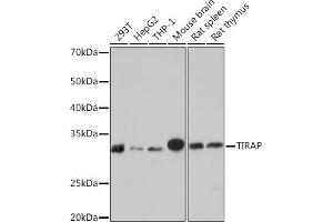 Western blot analysis of extracts of various cell lines, using TIRAP Rabbit mAb (ABIN7270842) at 1:1000 dilution. (TIRAP antibody)