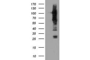 Western Blotting (WB) image for anti-Transforming, Acidic Coiled-Coil Containing Protein 3 (TACC3) antibody (ABIN1498101) (TACC3 antibody)