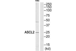 Western Blotting (WB) image for anti-Achaete-Scute Complex Homolog 2 (ASCL2) (Internal Region) antibody (ABIN1849922) (ASCL2 antibody  (Internal Region))