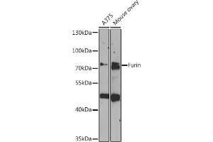 Western blot analysis of extracts of various cell lines, using Furin antibody (ABIN6127932, ABIN6140814, ABIN6140816 and ABIN6217288) at 1:1000 dilution. (FURIN antibody  (AA 120-370))