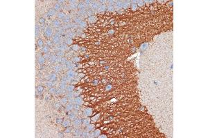 Immunohistochemistry (IHC) image for anti-Protein Kinase, CAMP-Dependent, Regulatory, Type II, beta (PRKAR2B) antibody (ABIN7269663)