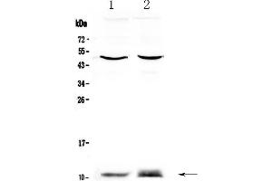 Western blot analysis of S100A10 using anti-S100A10 antibody .
