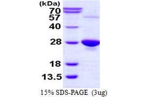SDS-PAGE (SDS) image for GPX1(U49C) (AA 1-203) protein (His tag) (ABIN667598) (GPX1(U49C) (AA 1-203) protein (His tag))