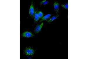 IF analysis of AEBP2 using anti-AEBP2 antibody (ABIN4886435). (AEBP2 antibody  (AA 424-517))
