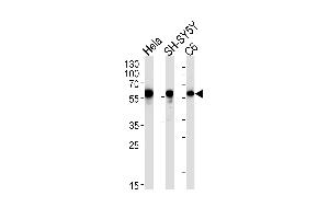 Western blot analysis in Hela,SH-SY5Y,rat C6 cell line lysates (35ug/lane). (GOPC antibody)