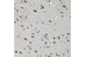 Immunohistochemistry (Paraffin-embedded Sections) (IHC (p)) image for anti-Peptidylprolyl Isomerase D (PPID) (AA 161-370) antibody (ABIN6146025)