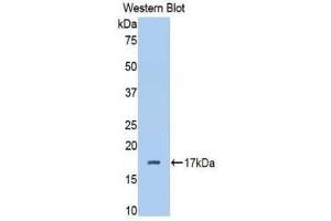 Western Blotting (WB) image for anti-Complement Factor B (CFB) (AA 477-600) antibody (ABIN1858375) (Complement Factor B antibody  (AA 477-600))