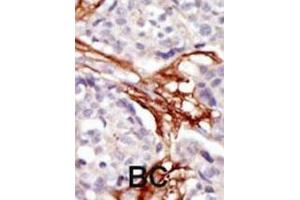 Immunohistochemistry (IHC) image for anti-V-Yes-1 Yamaguchi Sarcoma Viral Oncogene Homolog 1 (YES1) antibody (ABIN3003458)