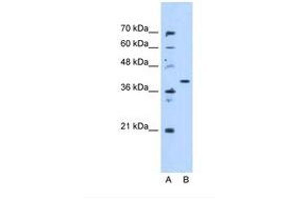 ECHDC3 antibody  (AA 71-120)