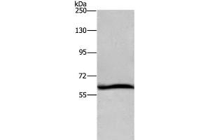 Western Blot analysis of Hela cell using DCP1A Polyclonal Antibody at dilution of 1:1100 (DCP1A antibody)