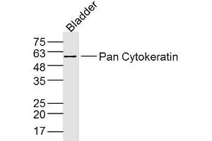 Mouse Bladder lysates probed with Pan Cytokeratin Polyclonal Antibody, Unconjugated  at 1:300 dilution and 4˚C overnight incubation. (Cytokeratin 1 antibody  (AA 141-240))