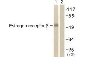 Western blot analysis of extracts from HeLa cells, treated with EGF 200ng/ml 30', using Estrogen Receptor-beta (Ab-105) Antibody. (ESR2 antibody  (AA 71-120))