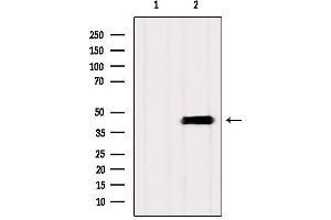 Western blot analysis of extracts from Mouse brain, using ASBT Antibody. (SLC10A2 antibody  (C-Term))